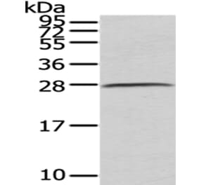 C1QB Antibody from Signalway Antibody (43026) - Antibodies.com