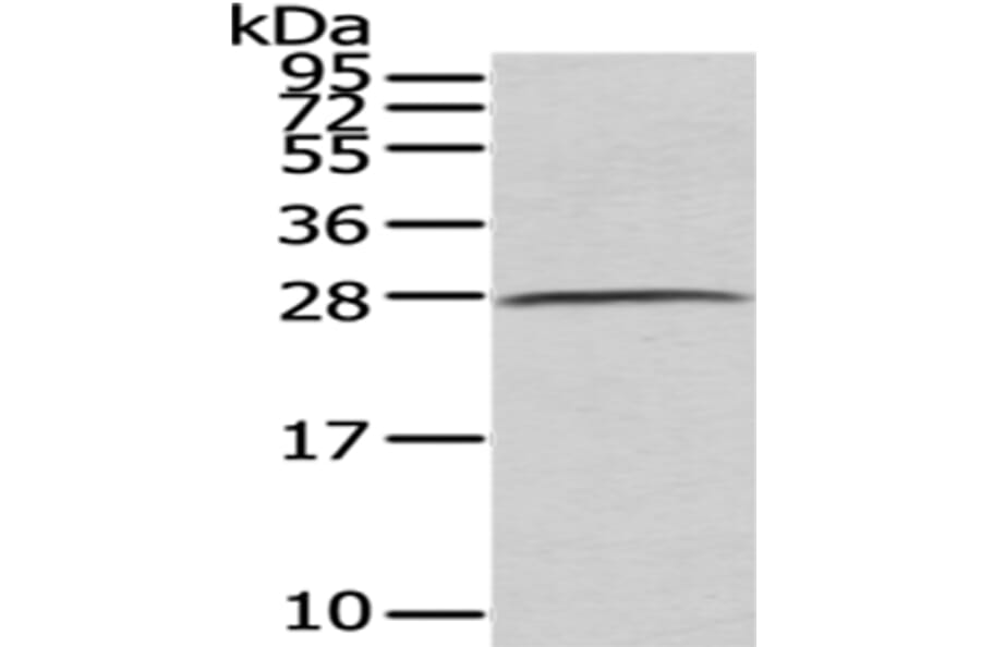 C1QB Antibody from Signalway Antibody (43026) - Antibodies.com