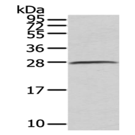 C1QB Antibody from Signalway Antibody (43026) - Antibodies.com