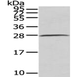 C1QB Antibody from Signalway Antibody (43026) - Antibodies.com