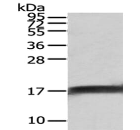 NPC2 Antibody from Signalway Antibody (43028) - Antibodies.com