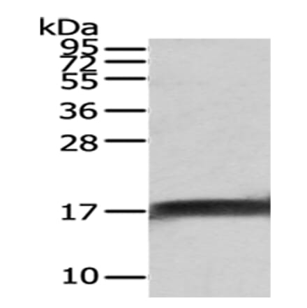 NPC2 Antibody from Signalway Antibody (43028) - Antibodies.com