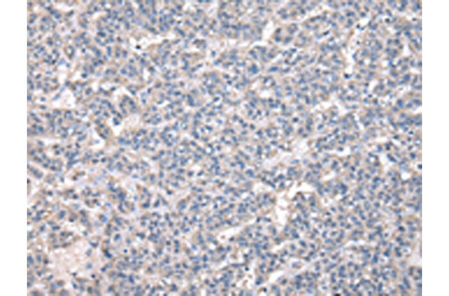 Immunohistochemistry - NPC2 Antibody from Signalway Antibody (43028) - Antibodies.com