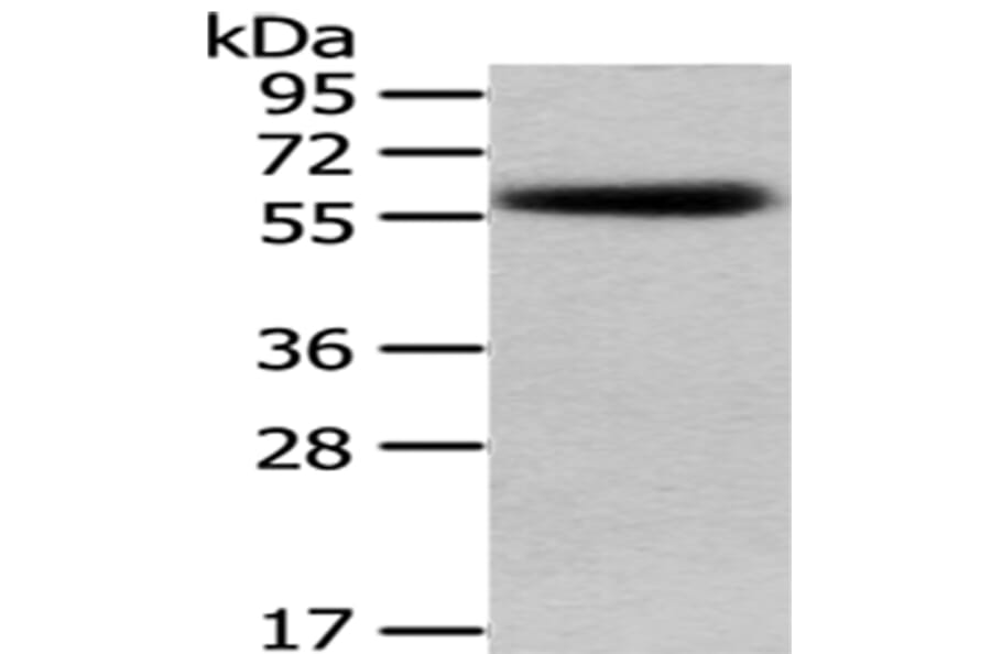 PEPD Antibody from Signalway Antibody (43029) - Antibodies.com