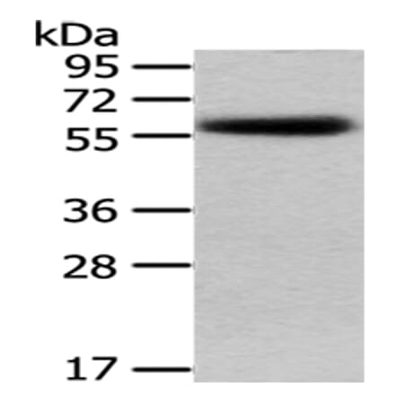 PEPD Antibody from Signalway Antibody (43029) - Antibodies.com