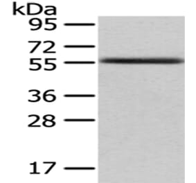 UMPS Antibody from Signalway Antibody (43030) - Antibodies.com
