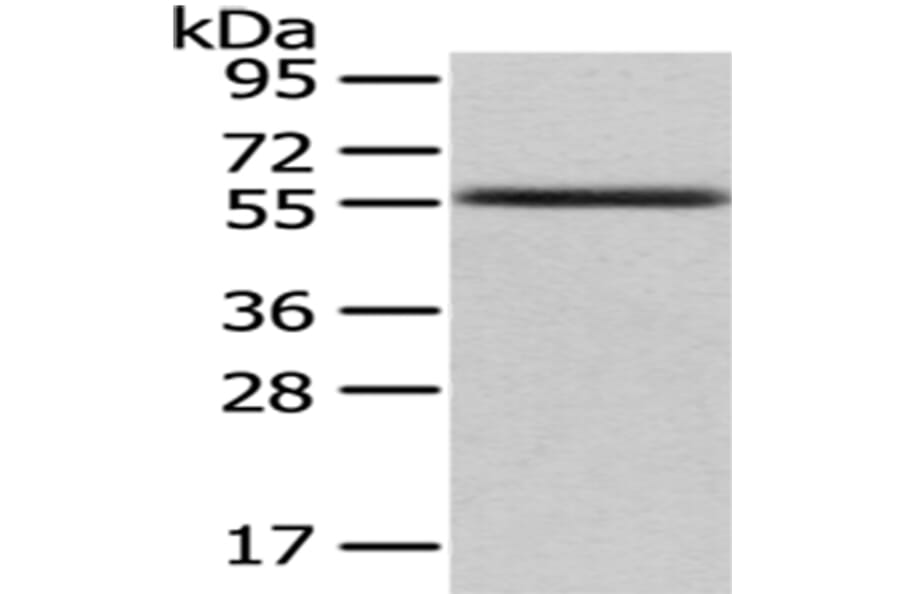 UMPS Antibody from Signalway Antibody (43030) - Antibodies.com