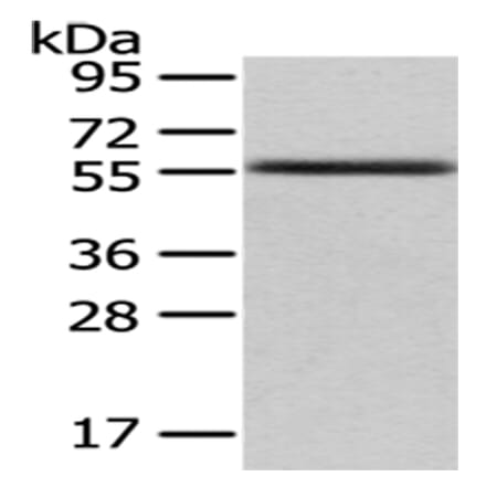 UMPS Antibody from Signalway Antibody (43030) - Antibodies.com