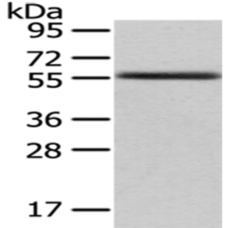 UMPS Antibody from Signalway Antibody (43030) - Antibodies.com