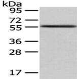 UMPS Antibody from Signalway Antibody (43030) - Antibodies.com