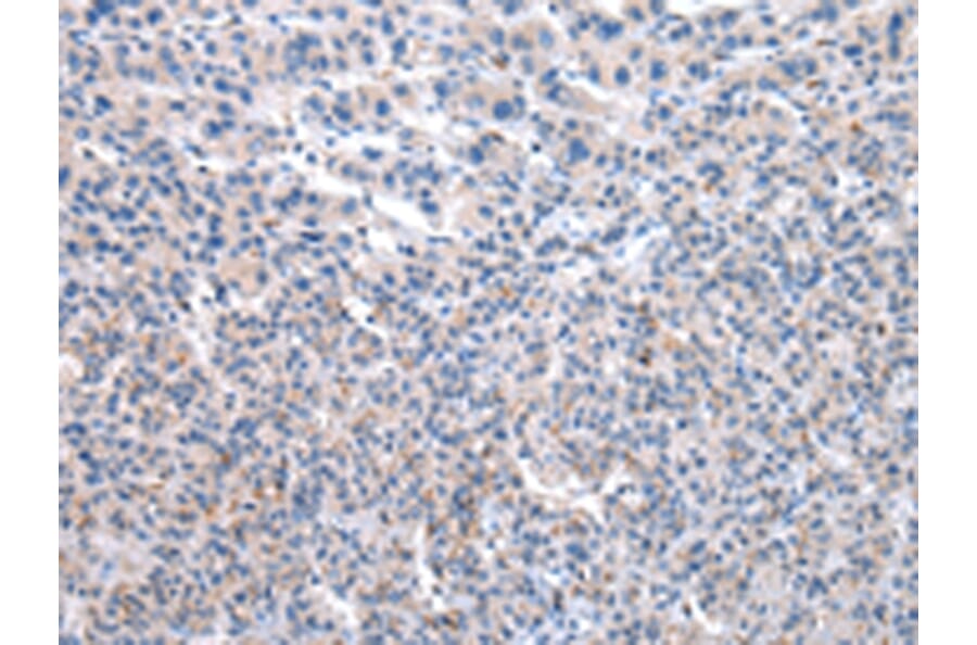 Immunohistochemistry - UMPS Antibody from Signalway Antibody (43030) - Antibodies.com