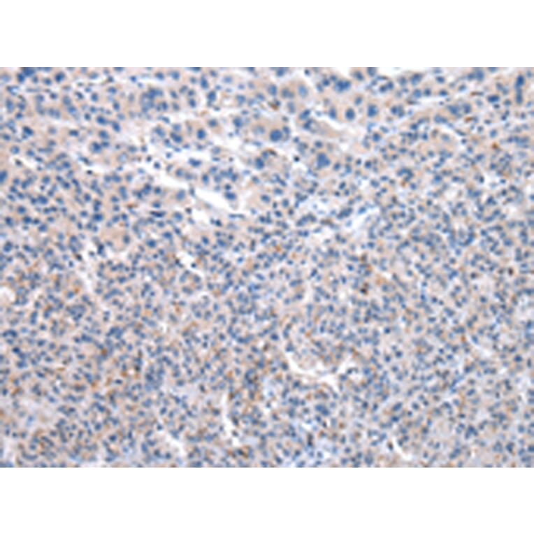Immunohistochemistry - UMPS Antibody from Signalway Antibody (43030) - Antibodies.com