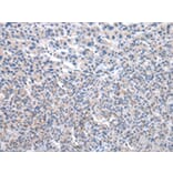 Immunohistochemistry - UMPS Antibody from Signalway Antibody (43030) - Antibodies.com