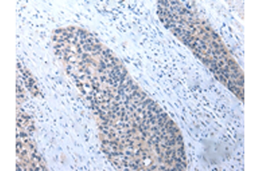 Immunohistochemistry - UMPS Antibody from Signalway Antibody (43030) - Antibodies.com