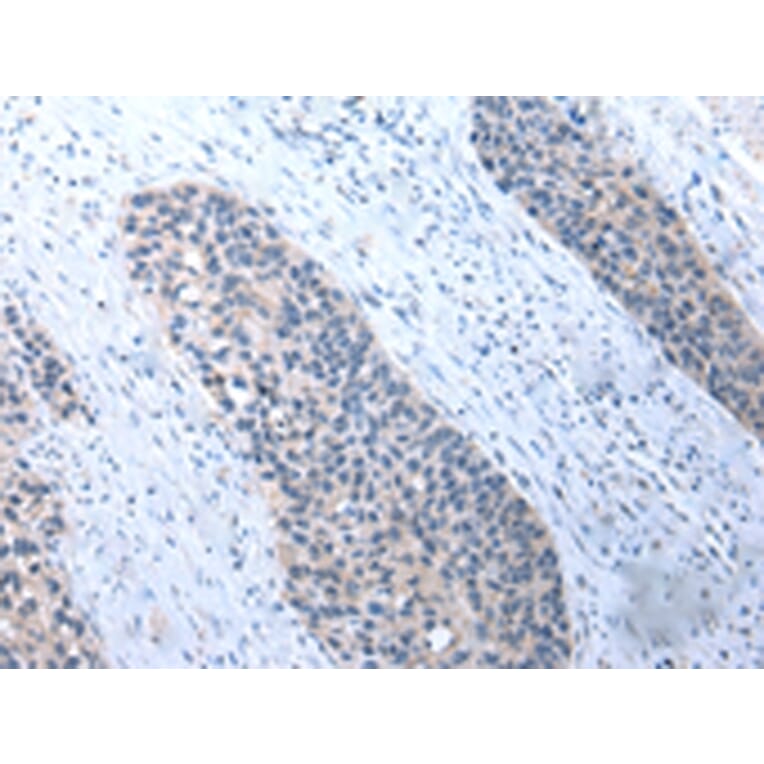 Immunohistochemistry - UMPS Antibody from Signalway Antibody (43030) - Antibodies.com
