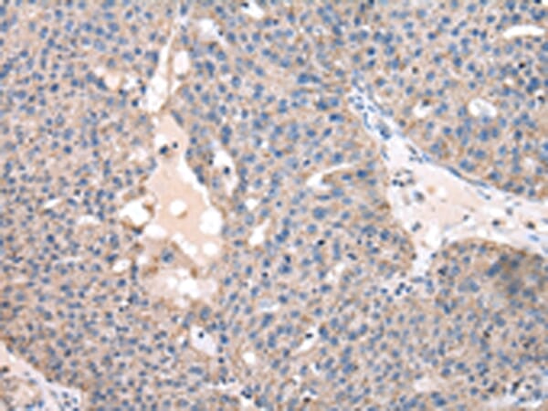 Anti-FZR1 Antibody (A38974) | Antibodies.com