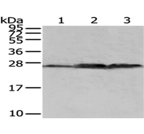 QDPR Antibody from Signalway Antibody (43037) - Antibodies.com