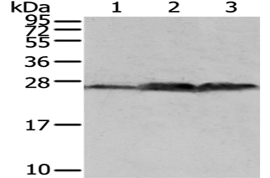 QDPR Antibody from Signalway Antibody (43037) - Antibodies.com