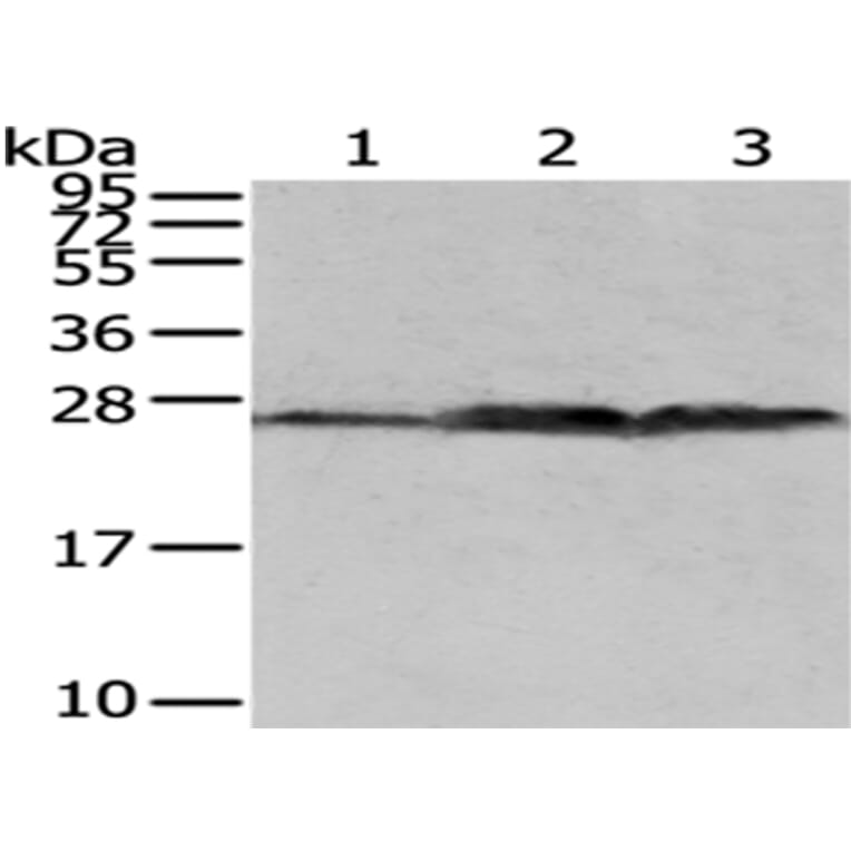QDPR Antibody from Signalway Antibody (43037) - Antibodies.com