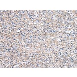 Immunohistochemistry - QDPR Antibody from Signalway Antibody (43037) - Antibodies.com