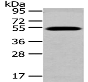 TCN2 Antibody from Signalway Antibody (43039) - Antibodies.com