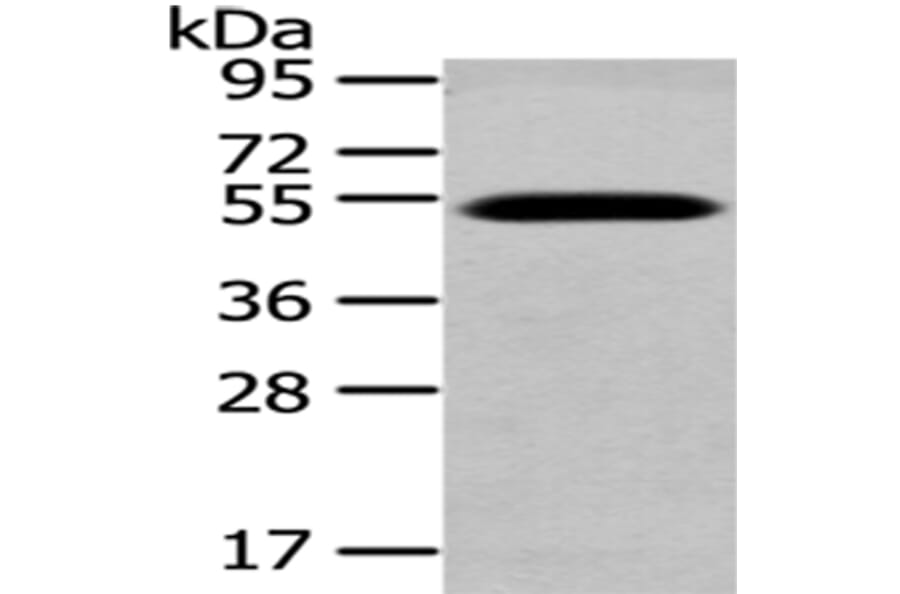 TCN2 Antibody from Signalway Antibody (43039) - Antibodies.com