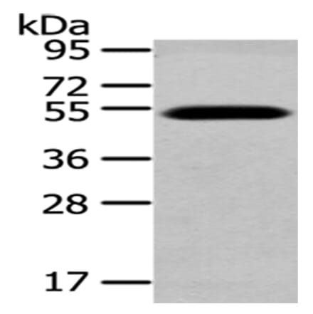 TCN2 Antibody from Signalway Antibody (43039) - Antibodies.com