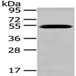 TCN2 Antibody from Signalway Antibody (43039) - Antibodies.com