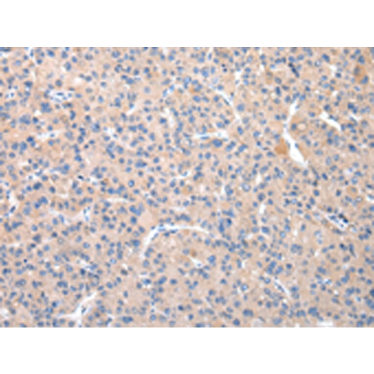 Immunohistochemistry - TCN2 Antibody from Signalway Antibody (43039) - Antibodies.com