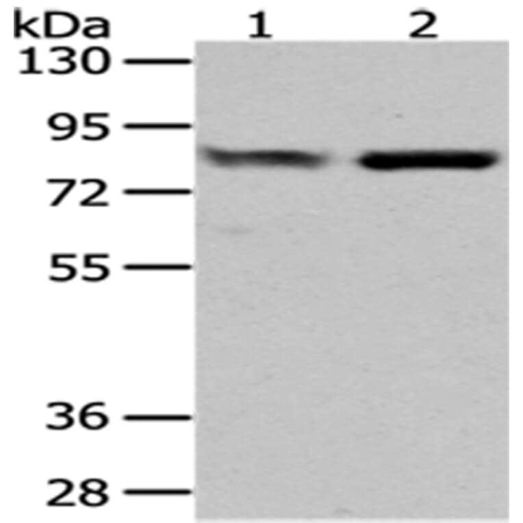 GUSB Antibody from Signalway Antibody (43041) - Antibodies.com