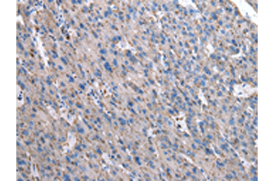 Immunohistochemistry - GUSB Antibody from Signalway Antibody (43041) - Antibodies.com
