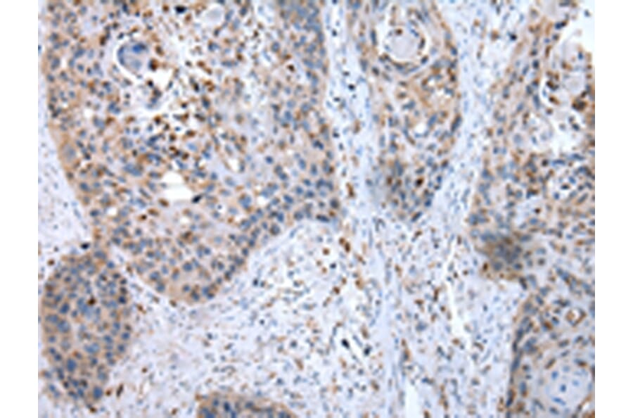 Immunohistochemistry - GUSB Antibody from Signalway Antibody (43041) - Antibodies.com