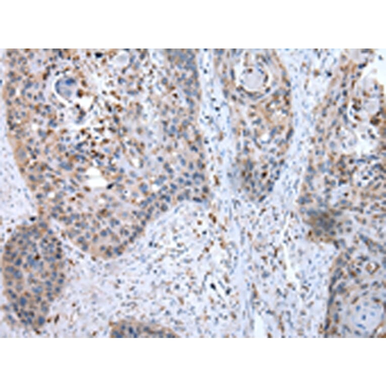 Immunohistochemistry - GUSB Antibody from Signalway Antibody (43041) - Antibodies.com