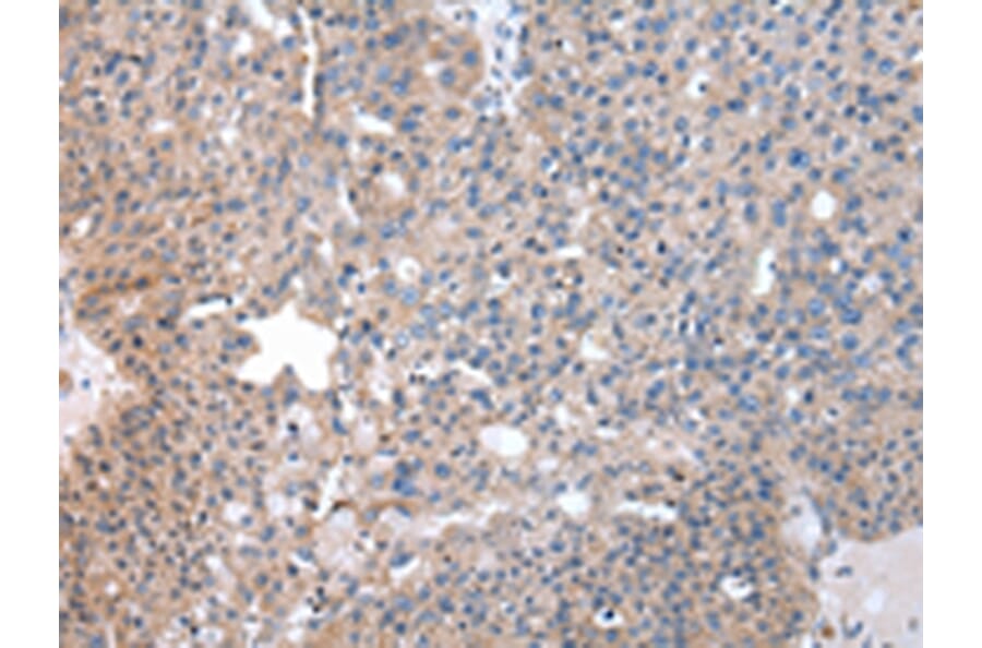 Immunohistochemistry - SND1 Antibody from Signalway Antibody (43043) - Antibodies.com