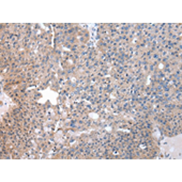 Immunohistochemistry - SND1 Antibody from Signalway Antibody (43043) - Antibodies.com