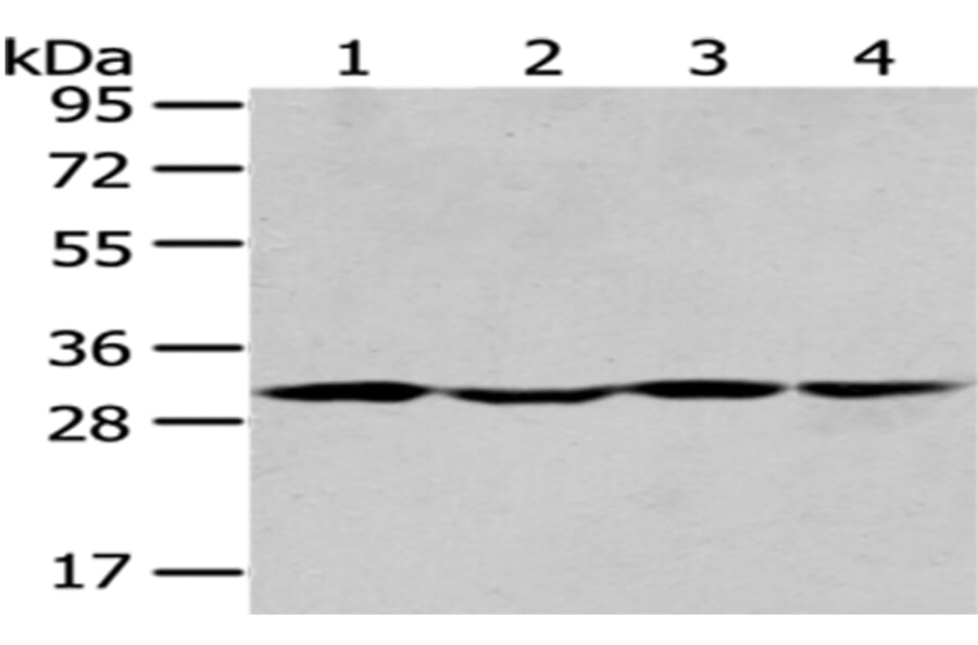 SBDS Antibody from Signalway Antibody (43044) - Antibodies.com