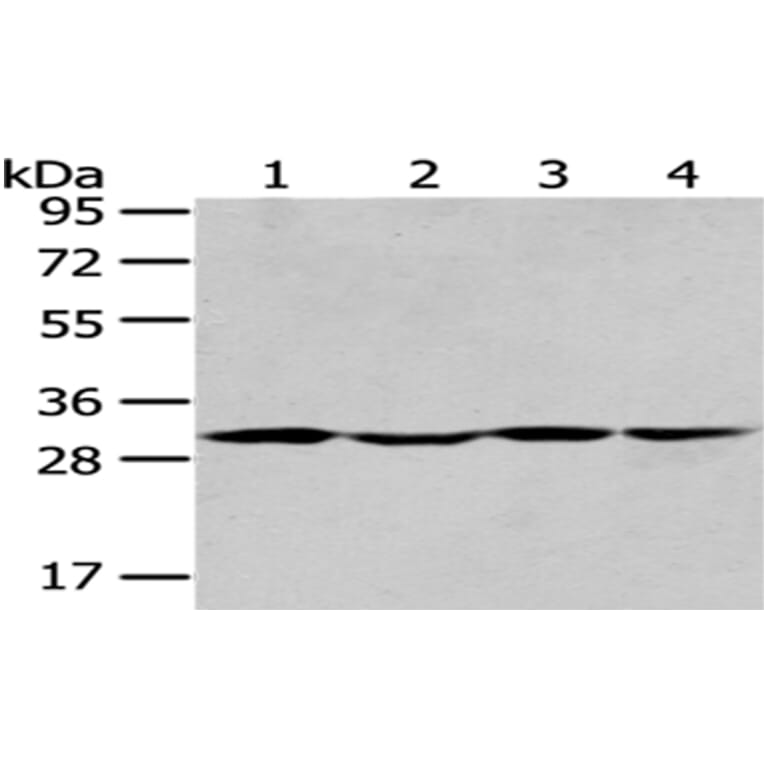 SBDS Antibody from Signalway Antibody (43044) - Antibodies.com