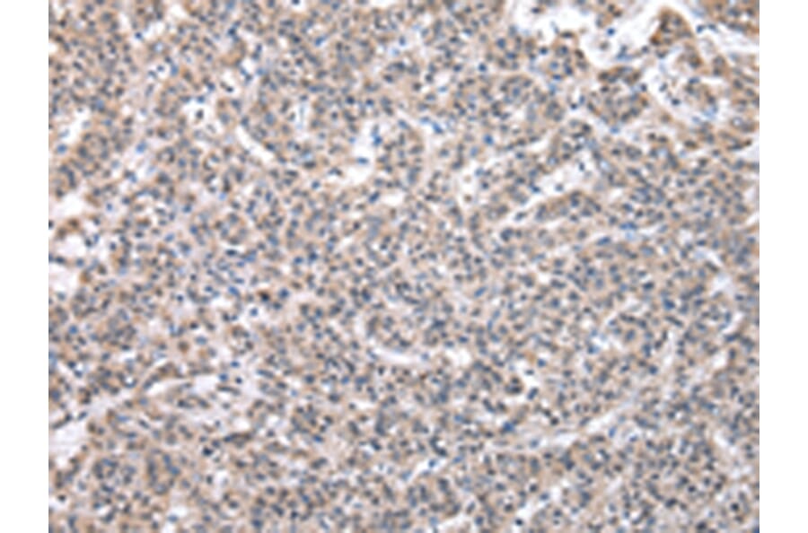 Immunohistochemistry - SBDS Antibody from Signalway Antibody (43044) - Antibodies.com