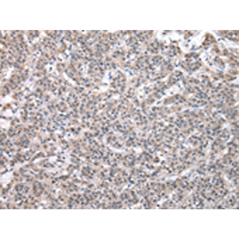 Immunohistochemistry - SBDS Antibody from Signalway Antibody (43044) - Antibodies.com