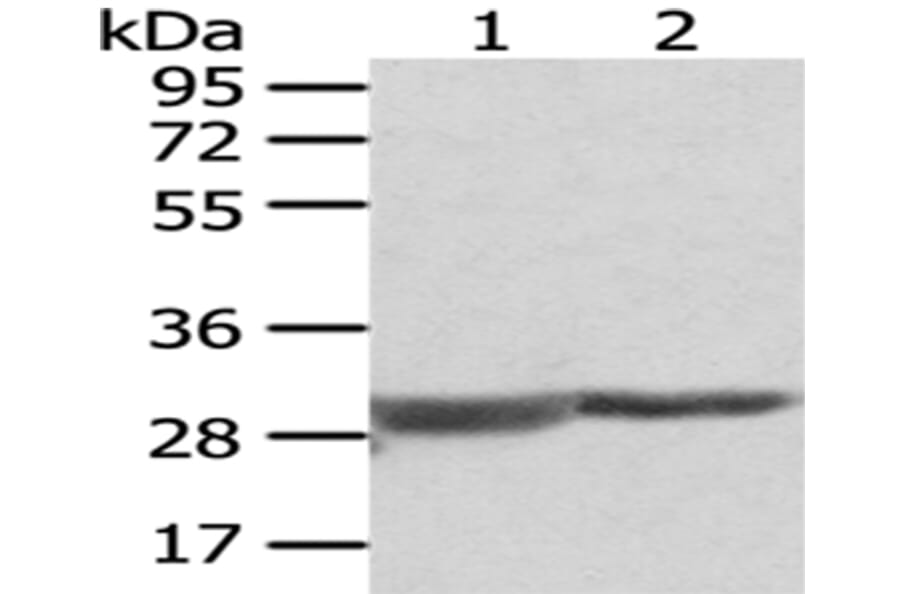 COMT Antibody from Signalway Antibody (43047) - Antibodies.com