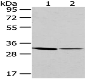M6PR Antibody from Signalway Antibody (43050) - Antibodies.com