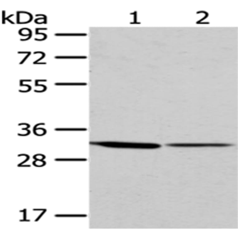 M6PR Antibody from Signalway Antibody (43050) - Antibodies.com