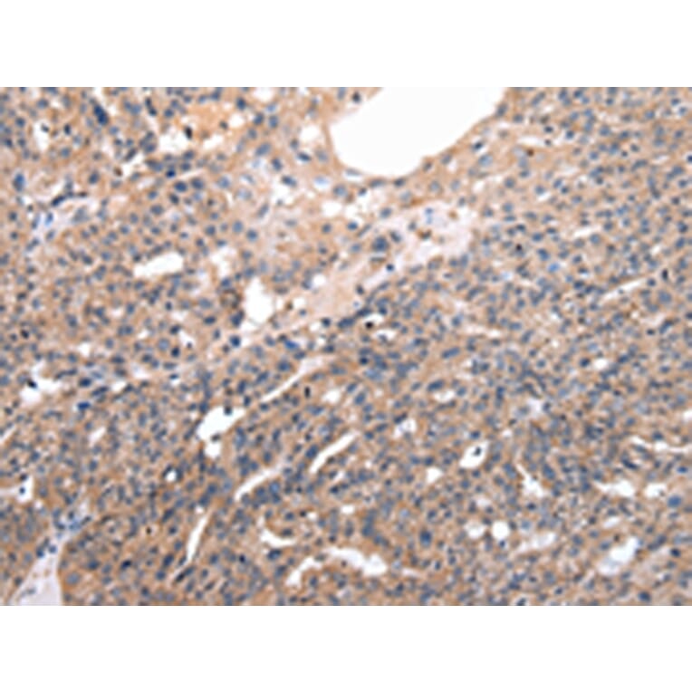 Immunohistochemistry - M6PR Antibody from Signalway Antibody (43050) - Antibodies.com