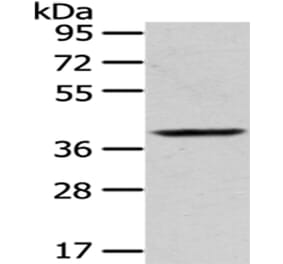 PLEK Antibody from Signalway Antibody (43053) - Antibodies.com