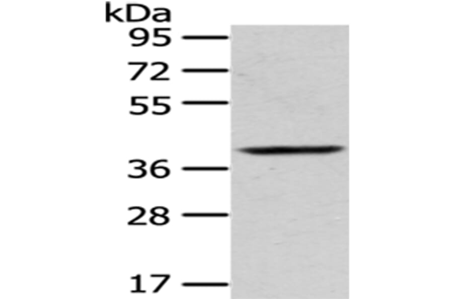 PLEK Antibody from Signalway Antibody (43053) - Antibodies.com