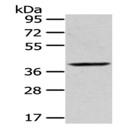 PLEK Antibody from Signalway Antibody (43053) - Antibodies.com