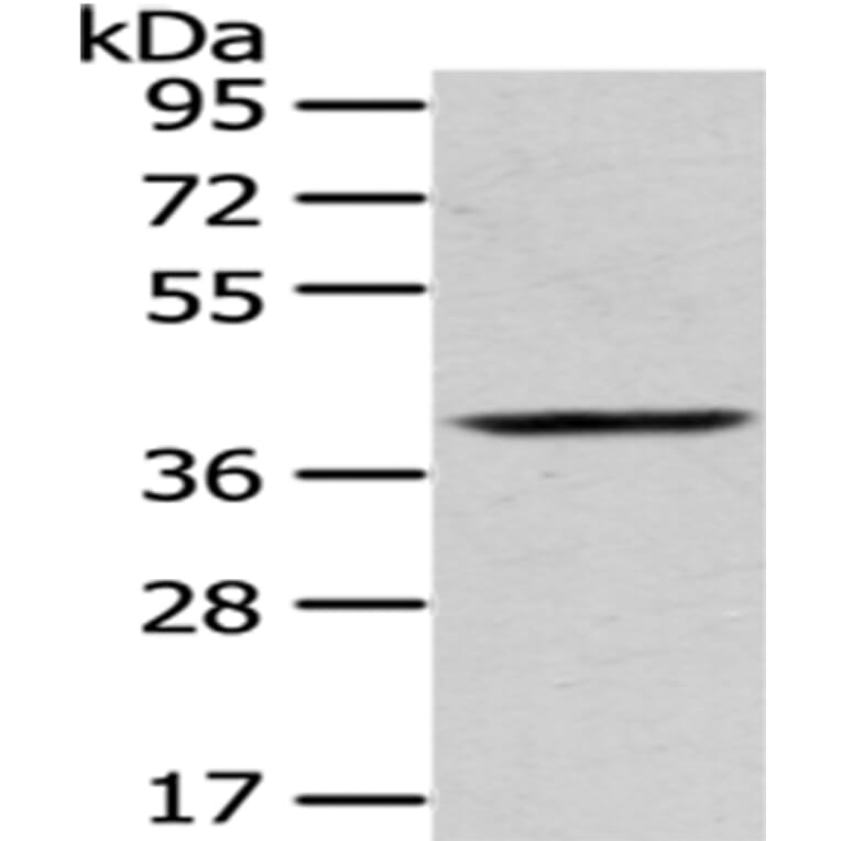 PLEK Antibody from Signalway Antibody (43053) - Antibodies.com