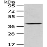 PLEK Antibody from Signalway Antibody (43053) - Antibodies.com