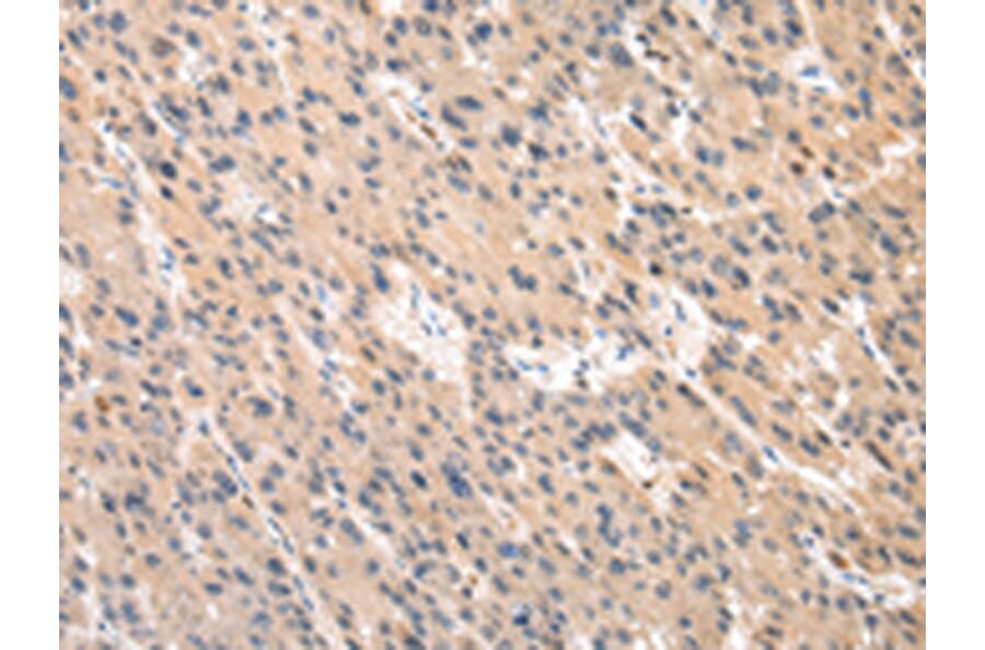 Immunohistochemistry - PLEK Antibody from Signalway Antibody (43053) - Antibodies.com