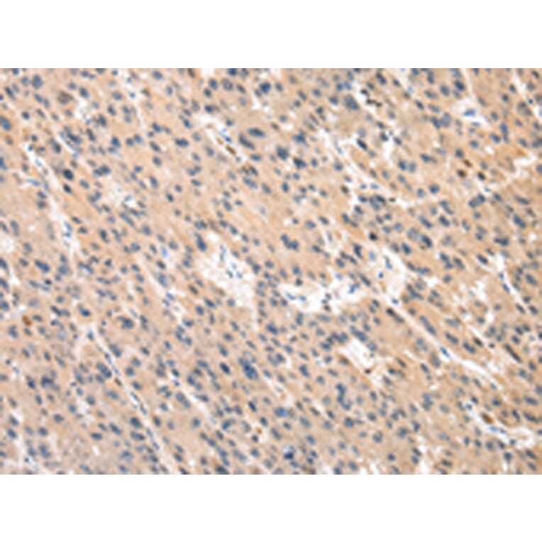 Immunohistochemistry - PLEK Antibody from Signalway Antibody (43053) - Antibodies.com